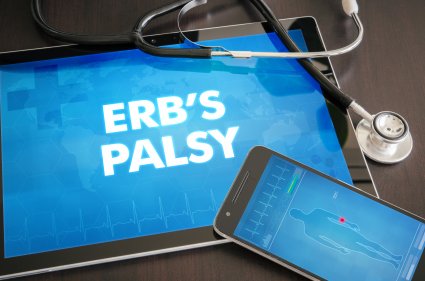 What New Parents Need to Know about Erb’s Palsy
