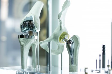 Hip Replacement Complications