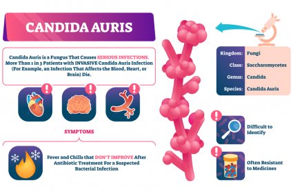 Candida Auris Could Be First Disease Due to Climate Change